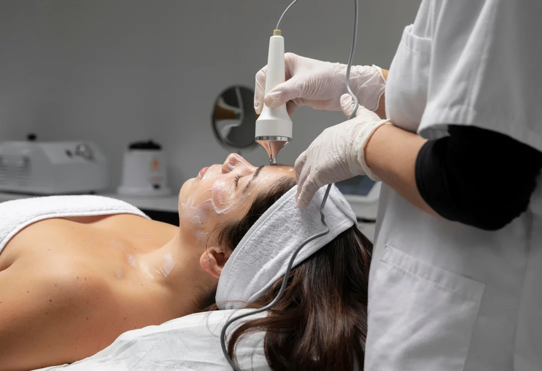 Chemical Peels