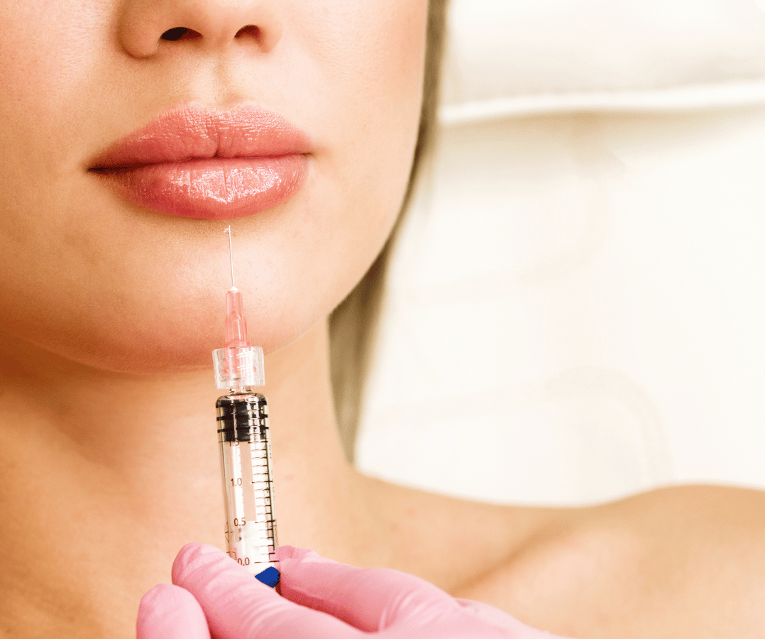 lip filler