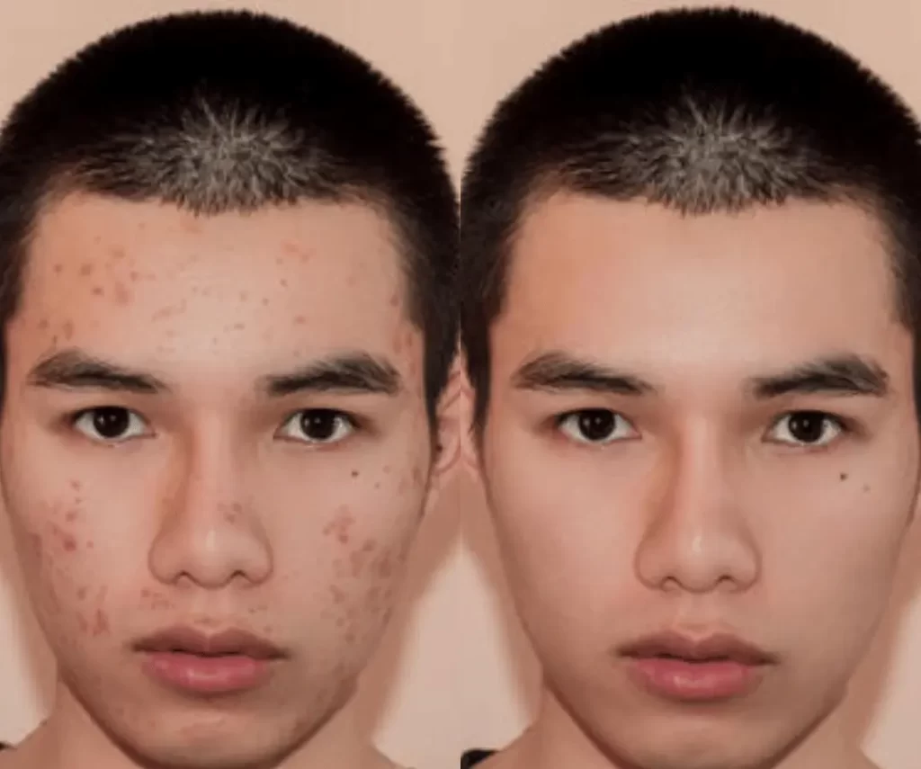 before and after mens aesthetic treatments