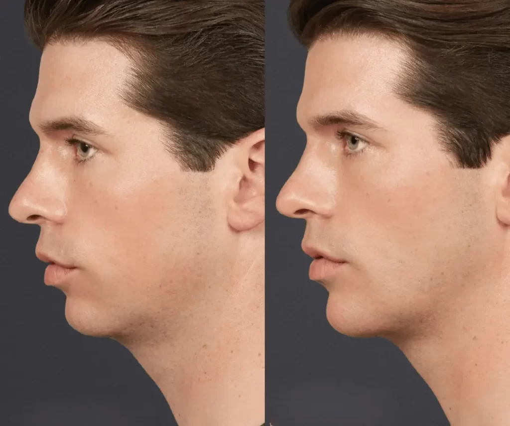 before and after mens aesthetic treatments