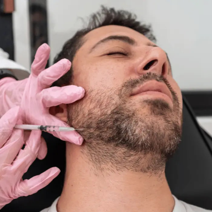 dermal filler treatment for men