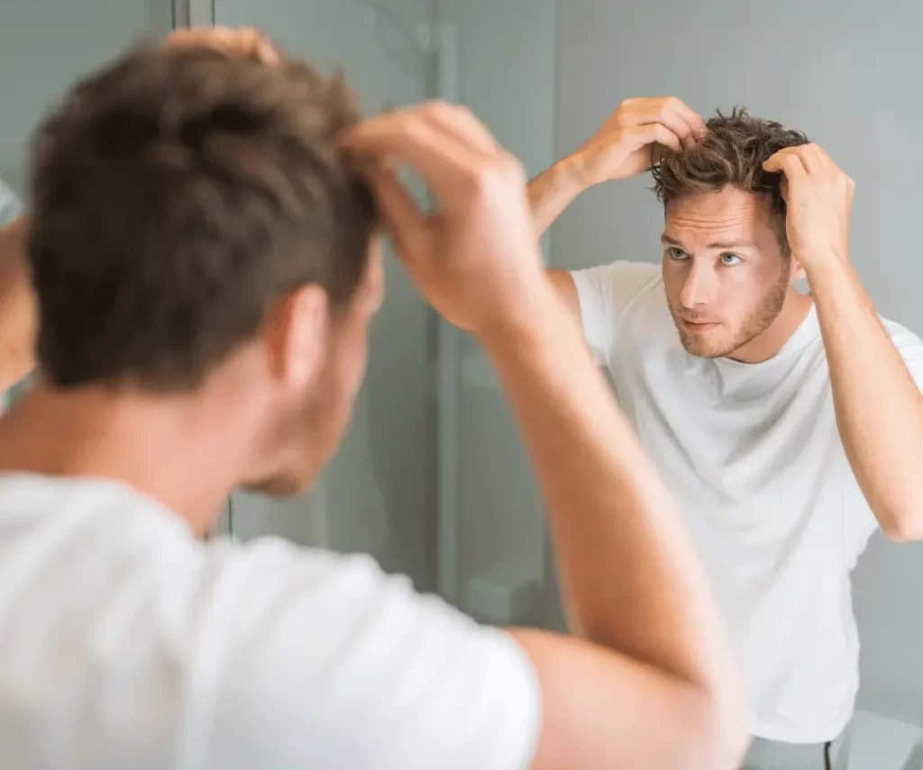 hair loss for men